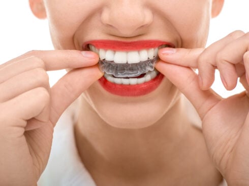 Dental Tech Startup Toothsi Bags $9 Mn In Debt Funding Toothsi makes dental products such as invisible 3D printed teeth and offers at-home dental services The startup said it has conducted more than 65,000 ‘smile makeovers’ so far and has recorded a 5x year-on-year growth over the previous year in FY2021 The global orthodontics market was valued at $4.06 Bn in 2018 and is projected to reach $9.72 Bn by 2026, growing at a CAGR of 11.6% Dental tech startup Toothsi has raised $9 Mn (INR 66.6 Cr) in a debt funding round led by Stride Ventures.